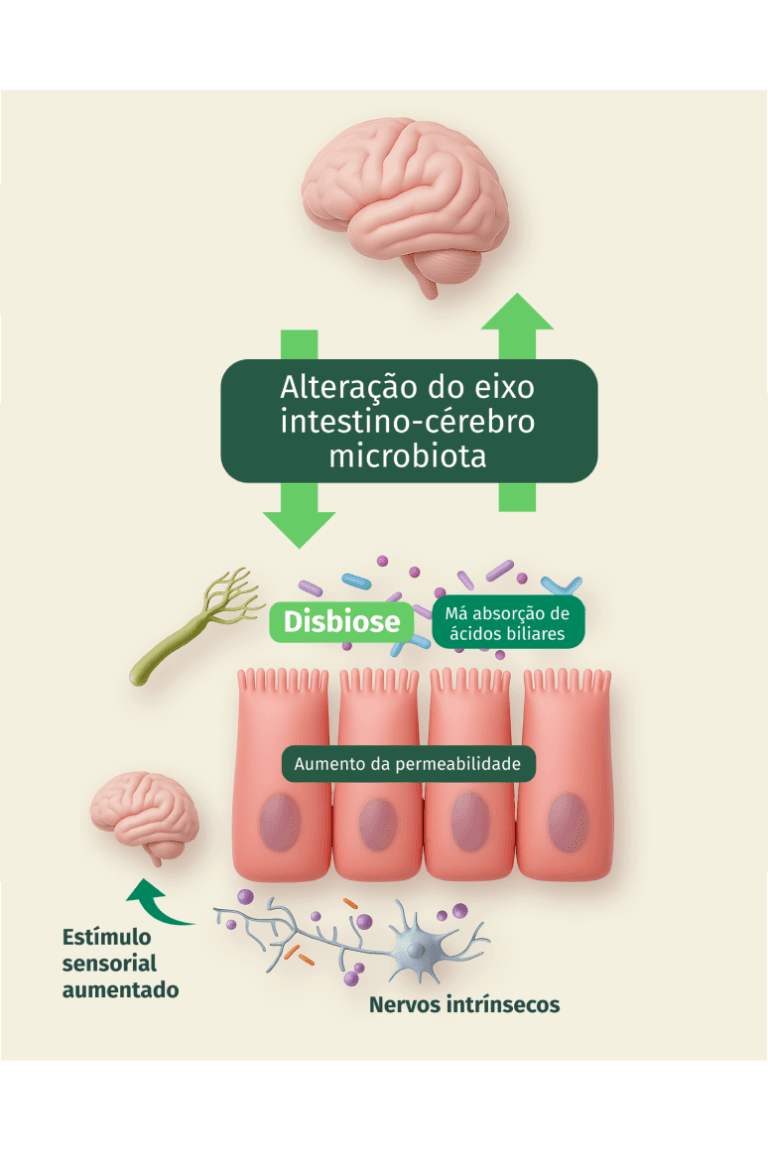 Ilustração do eixo intestino-cérebro-microbiota: setas ligam o cérebro ao intestino nos dois sentidos, indicando alteração do eixo intestino-cérebro-microbiota, disbiose, má absorção de ácidos biliares, aumento da permeabilidade intestinal, estímulo sensorial aumentado e nervos intrínsecos.