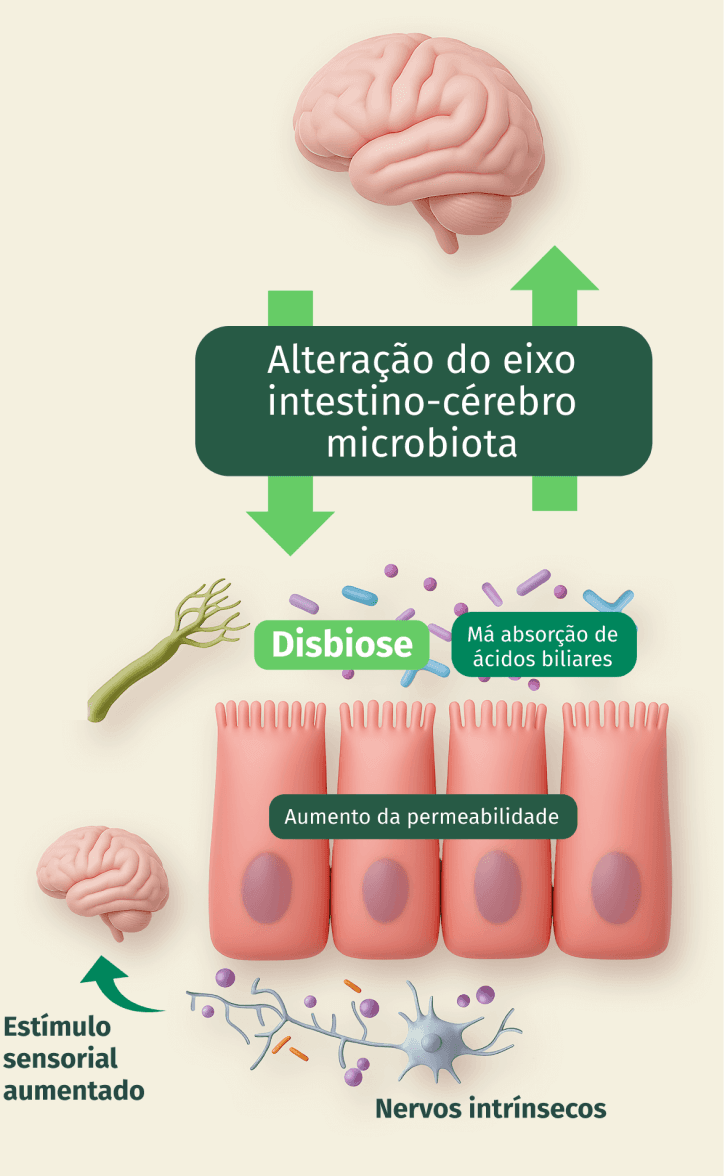 Ilustração do eixo intestino-cérebro-microbiota: setas ligam o cérebro ao intestino nos dois sentidos, indicando alteração do eixo intestino-cérebro-microbiota, disbiose, má absorção de ácidos biliares, aumento da permeabilidade intestinal, estímulo sensorial aumentado e nervos intrínsecos.