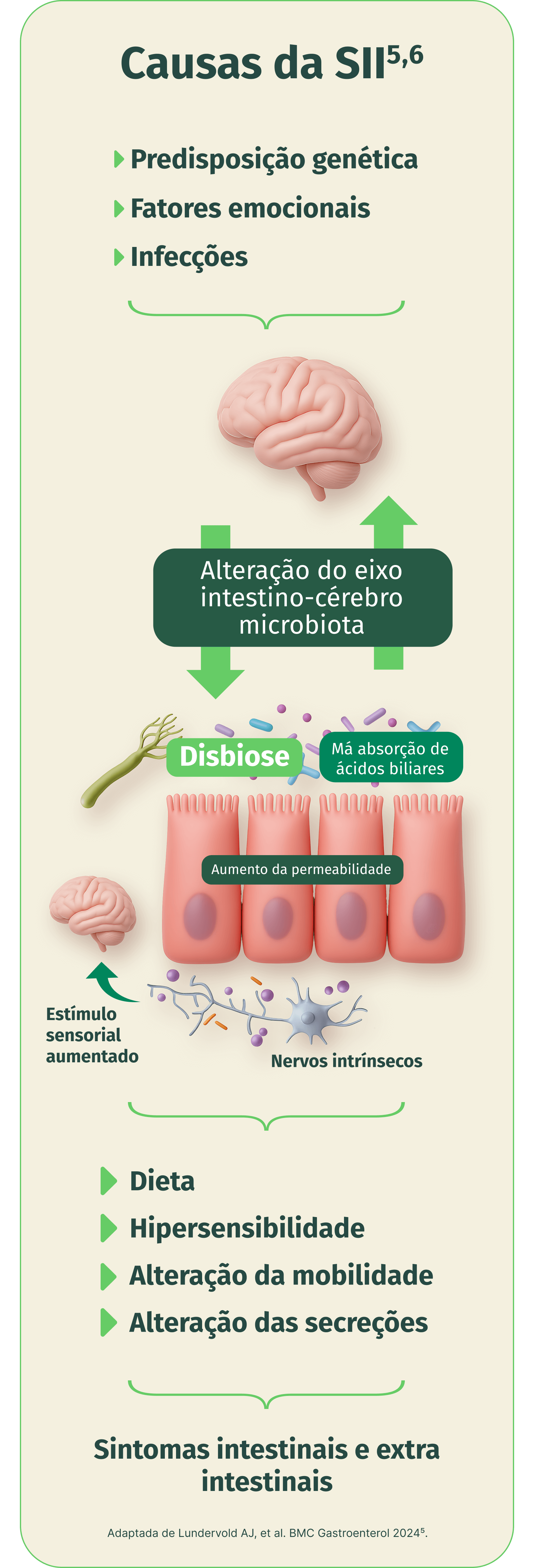 Infográfico sobre as causas da Síndrome do Intestino Irritável (SII). Mostra a alteração do eixo intestino-cérebro-microbiota como ponto central, ligada a predisposição genética, fatores emocionais e infecções, que levam à disbiose, aumento da permeabilidade intestinal, má absorção de ácidos biliares, estímulo sensorial aumentado e nervos intrínsecos. Também está associada a dieta, hipersensibilidade, alteração da mobilidade e das secreções, resultando em sintomas intestinais e extra intestinais.