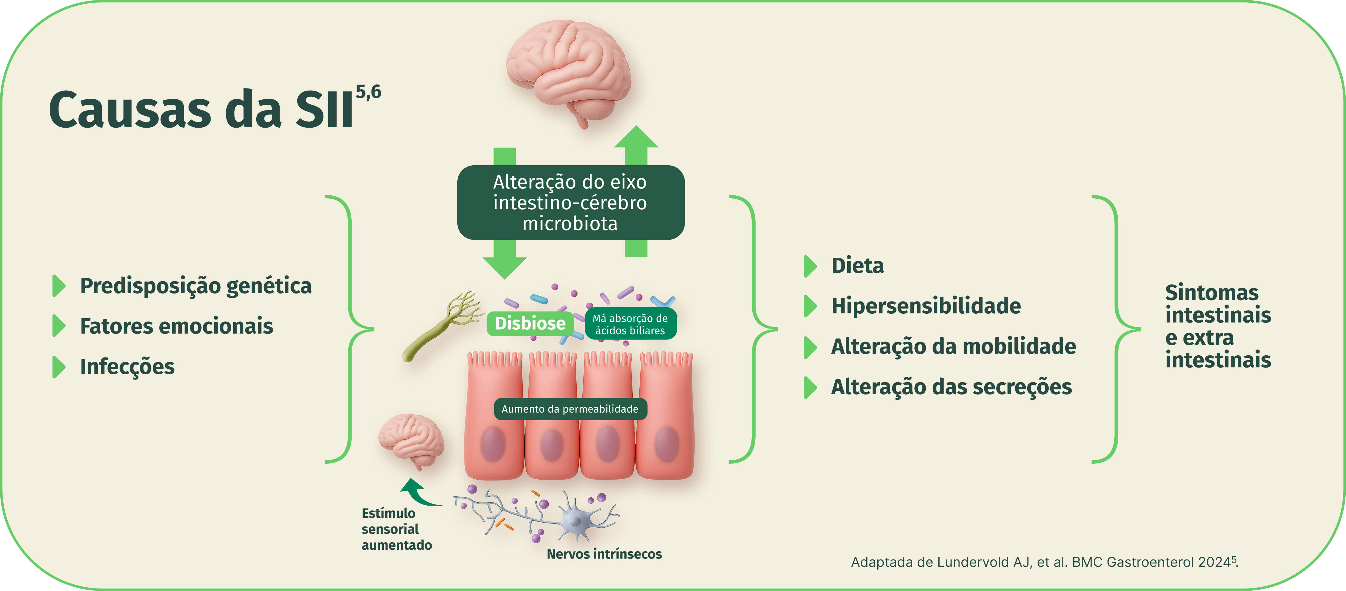 Infográfico sobre as causas da Síndrome do Intestino Irritável (SII). Mostra a alteração do eixo intestino-cérebro-microbiota como ponto central, ligada a predisposição genética, fatores emocionais e infecções, que levam à disbiose, aumento da permeabilidade intestinal, má absorção de ácidos biliares, estímulo sensorial aumentado e nervos intrínsecos. Também está associada a dieta, hipersensibilidade, alteração da mobilidade e das secreções, resultando em sintomas intestinais e extra intestinais.